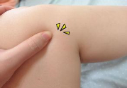 小腿水腫是什么原因引起的？教你輕松解決之道