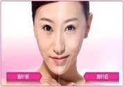美白針真的有效嗎？美白針的危害有哪些？