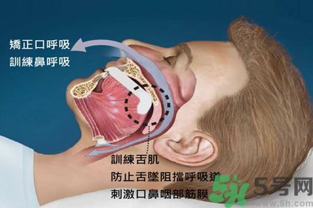 耳鳴是什么原因引起的？耳鳴怎么治療最好？