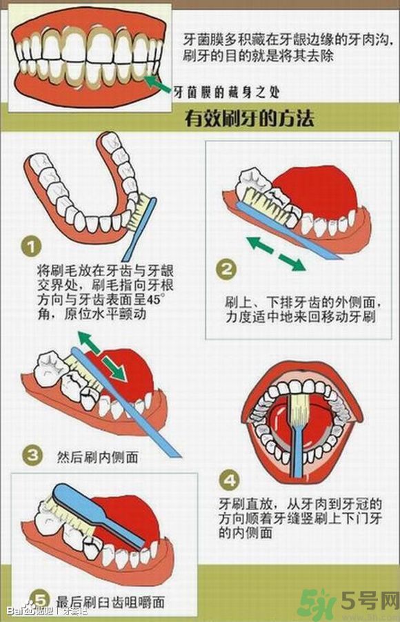 18歲還能戴牙套嗎？戴牙套真的能瘦臉改變臉型嗎？