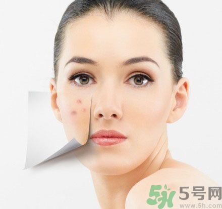 臉上有斑怎么去除？祛斑的小偏方有哪些？