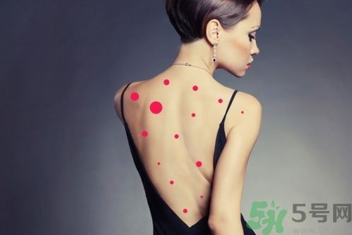 背上為什么會(huì)長(zhǎng)痘痘？長(zhǎng)痘痘怎么辦？