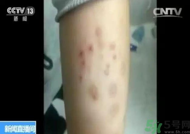 被污染學(xué)校是哪個(gè)？500師生患病的原因？