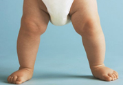 孩子一個腿長一個腿短是什么??？孩子長短腿怎么辦？
