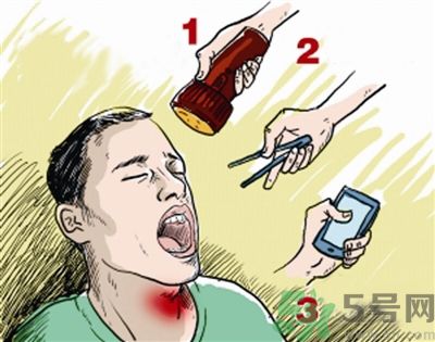 魚(yú)刺卡喉喝醋可以治療嗎？魚(yú)刺卡喉喝醋好不好？