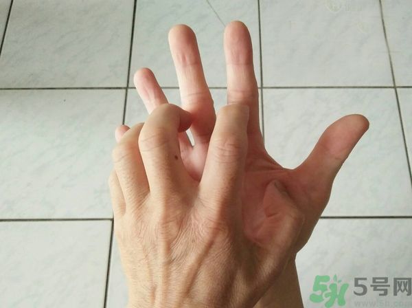 手上起水泡是什么原因？怎樣預(yù)防手上起水泡？
