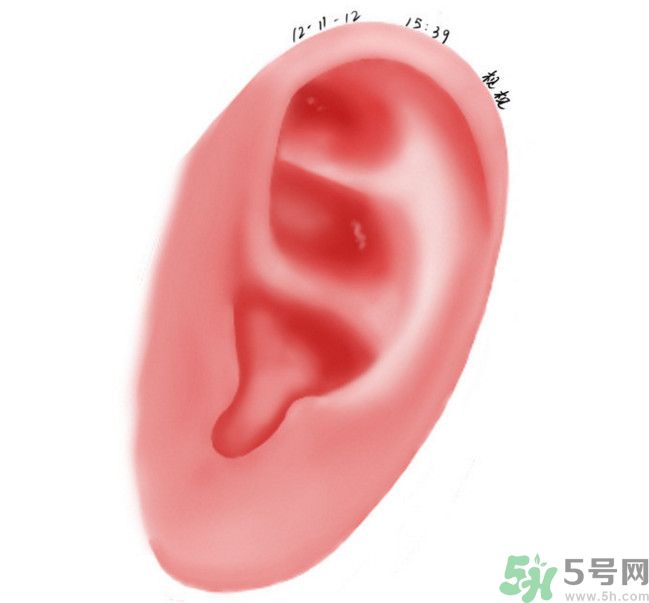 耳石脫落導(dǎo)致的眩暈怎么辦？耳石癥暈眩能自愈嗎？