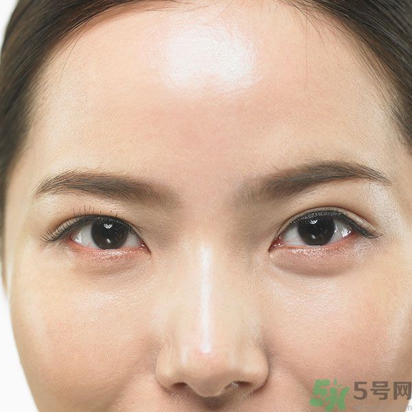 眉周紋是怎么形成的？眉周紋怎么去除？