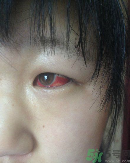 初中生全體甲醛中毒是怎么回事？初中生全體甲醛中毒是哪個學校？