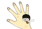 蚊子叮的包過幾天又癢是為什么？蚊子叮的包過幾天又癢怎么辦？