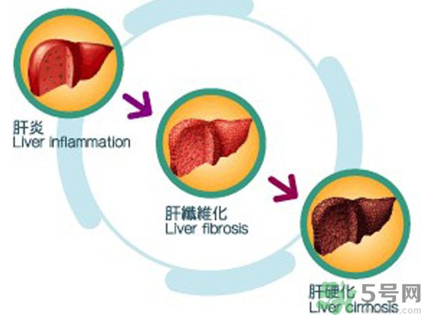 在外面吃飯會得乙肝嗎？在食堂吃飯會得乙肝嗎？
