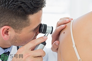 臉上長痣是什么原因？臉上為什么會(huì)長痣？
