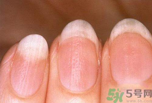 指甲發(fā)白是怎么回事？指甲發(fā)白代表什么？