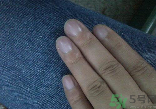 指甲發(fā)紫是什么原因？指甲發(fā)紫是怎么回事？