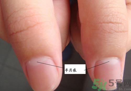 指甲沒有月牙是什么原因？指甲沒有月牙怎么調(diào)理？