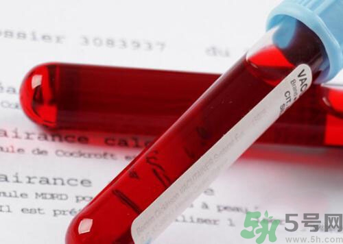 獻(xiàn)血后可以洗澡嗎？抽血后可以洗澡嗎？