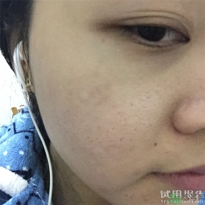 菲洛嘉十全大補(bǔ)面膜怎么用 菲洛嘉十全大補(bǔ)面膜使用方法 菲洛嘉十全大補(bǔ)面膜怎么用 菲洛嘉十全大補(bǔ)面膜使用方法