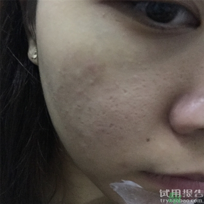 菲洛嘉十全大補(bǔ)面膜怎么用 菲洛嘉十全大補(bǔ)面膜使用方法 菲洛嘉十全大補(bǔ)面膜怎么用 菲洛嘉十全大補(bǔ)面膜使用方法