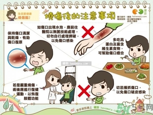 手被油燙傷了怎么處理？手被油燙起泡了怎么辦？
