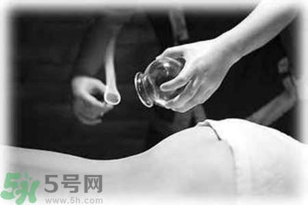 大暑可以拔罐嗎？大暑拔罐好不好？