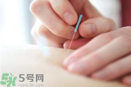 大暑可以針灸嗎？大暑針灸好不好？