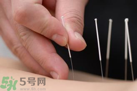 大暑可以針灸嗎？大暑針灸好不好？