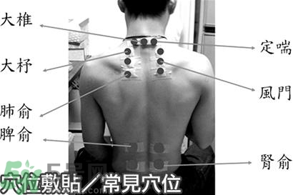 經(jīng)期可以貼三伏貼嗎？來月經(jīng)可以貼三伏貼嗎？
