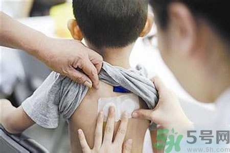肝炎貼三伏貼有用嗎？肝病貼三伏貼貼哪里？