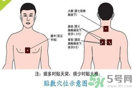 三伏貼能治頸椎病嗎？頸椎病三伏貼穴位