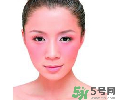 敏感性皮膚用什么洗面奶？敏感性皮膚怎么修復(fù)？