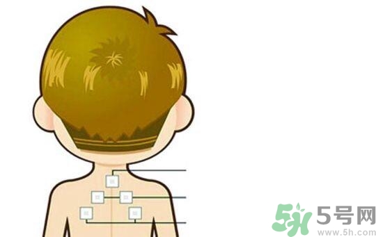 三伏貼可以去濕氣嗎？三伏貼去濕氣貼哪里？