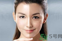 干性皮膚用什么洗面奶？干性皮膚該怎么保養(yǎng)？