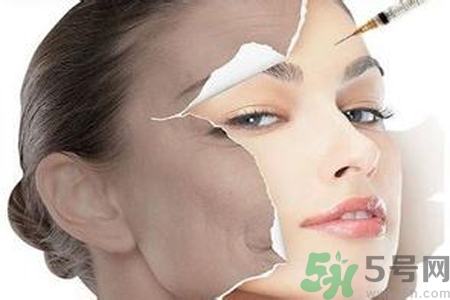 美白針效果怎么樣？美白針有副作用嗎？