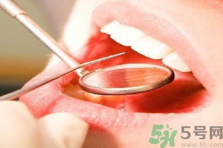 冷光美白牙齒是什么？冷光美白牙齒的好處有哪些？