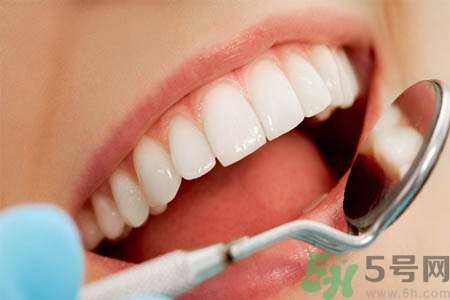 冷光美白牙齒的價(jià)格是多少？做冷光美白牙齒需要多少錢(qián)？