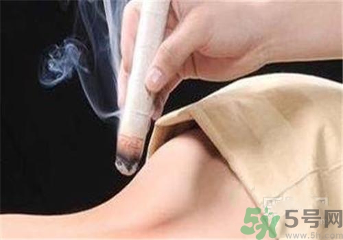 蕁麻疹可以艾灸嗎？蕁麻疹艾灸哪個(gè)穴位？
