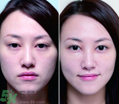臥蠶是什么？臥蠶是眼袋嗎？