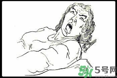 癲癇的護理措施？癲癇的飲食護理是什么？