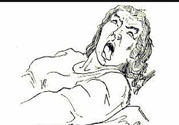 癲癇的發(fā)病因素？癲癇的并發(fā)癥有哪些？