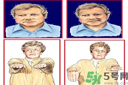 腦中風(fēng)是什么？腦中風(fēng)的癥狀？
