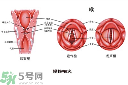 慢性咽炎是什么？慢性咽炎的癥狀有哪些？