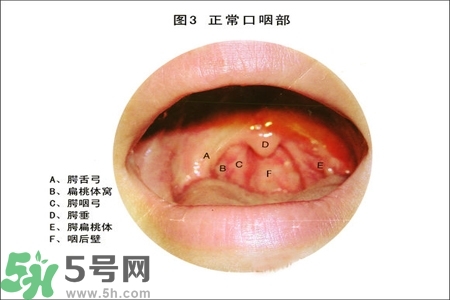 慢性咽炎的治療方法？慢性咽炎的藥物治療？