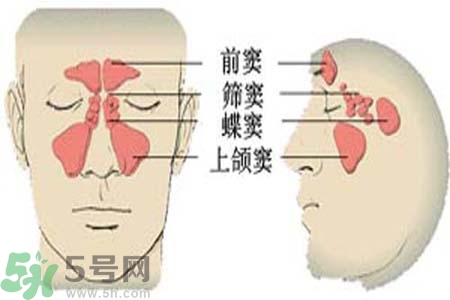 鼻竇炎是什么？鼻竇炎的癥狀有哪些？