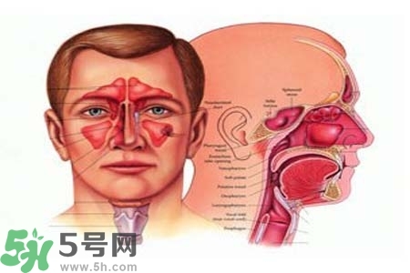 鼻竇炎的高發(fā)人群？如何預(yù)防鼻竇炎？