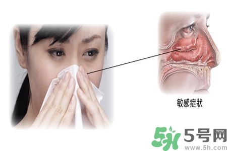 過(guò)敏性鼻炎的高發(fā)人群有哪些？如何預(yù)防過(guò)敏性鼻炎？