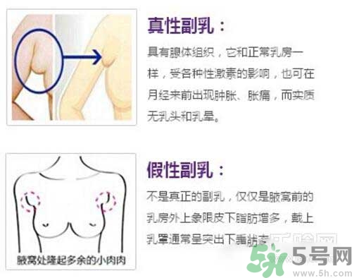 副乳是什么？副乳的危害