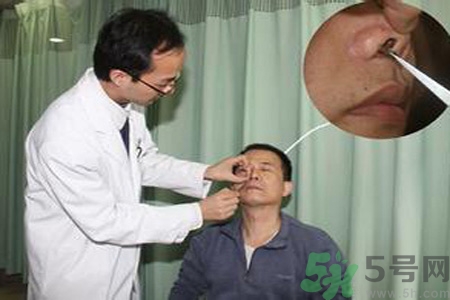 鼻咽癌的治療方法是什么？鼻咽癌可以用什么藥物治療？