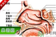鼻咽癌的發(fā)病因素是什么？鼻咽癌的并發(fā)癥有哪些？