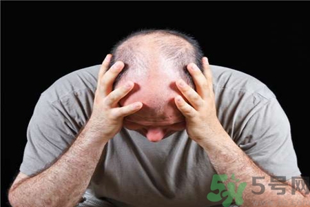 脫發(fā)的高發(fā)人群有哪些？如何預(yù)防脫發(fā)？