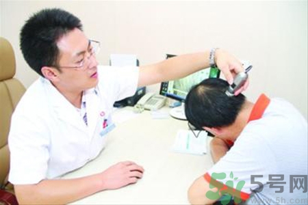 脫發(fā)會(huì)遺傳嗎？脫發(fā)遺傳可以治療嗎？